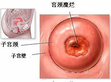 阿克苏无痛人流医院