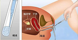 乳腺纤维瘤